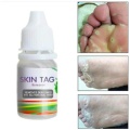 Corn Eye Treatment Solution Corns Exfoliator Callus Removal Liquid Foot Skin Care Product