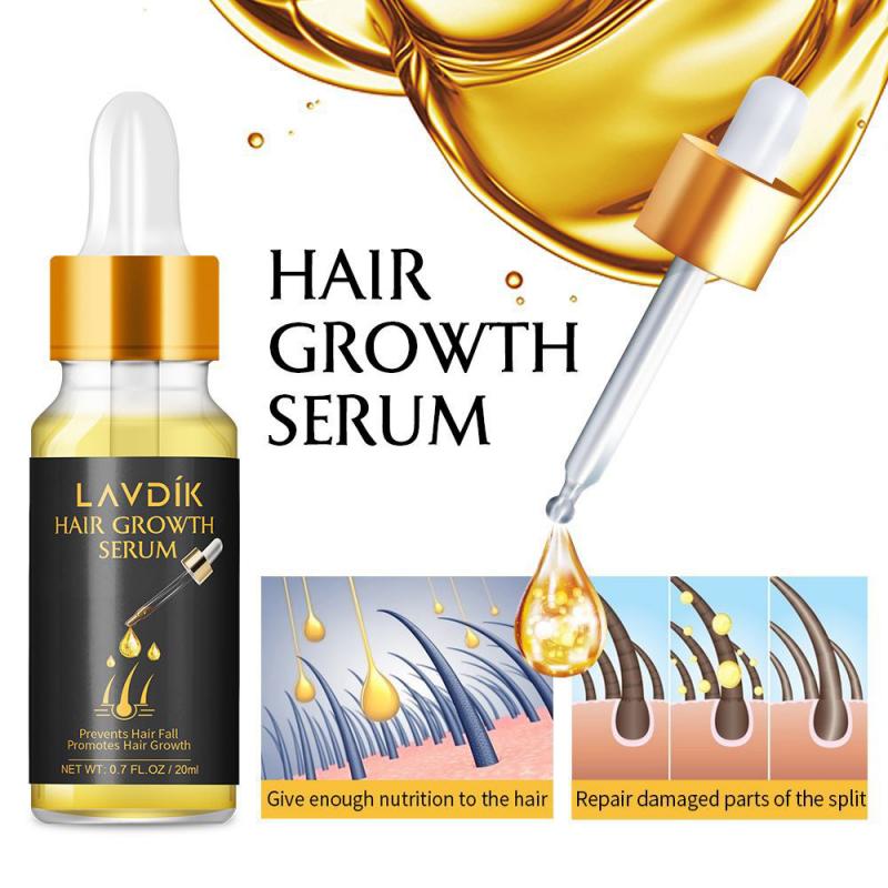 Women Men 20ml Ginger Fast Hair Growth Serum Essential Oil Anti Preventing Hair Loss Treatment Damaged Hair Repair Growing