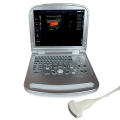 https://www.bossgoo.com/product-detail/full-digital-color-doppler-laptop-ultrasonic-63257961.html
