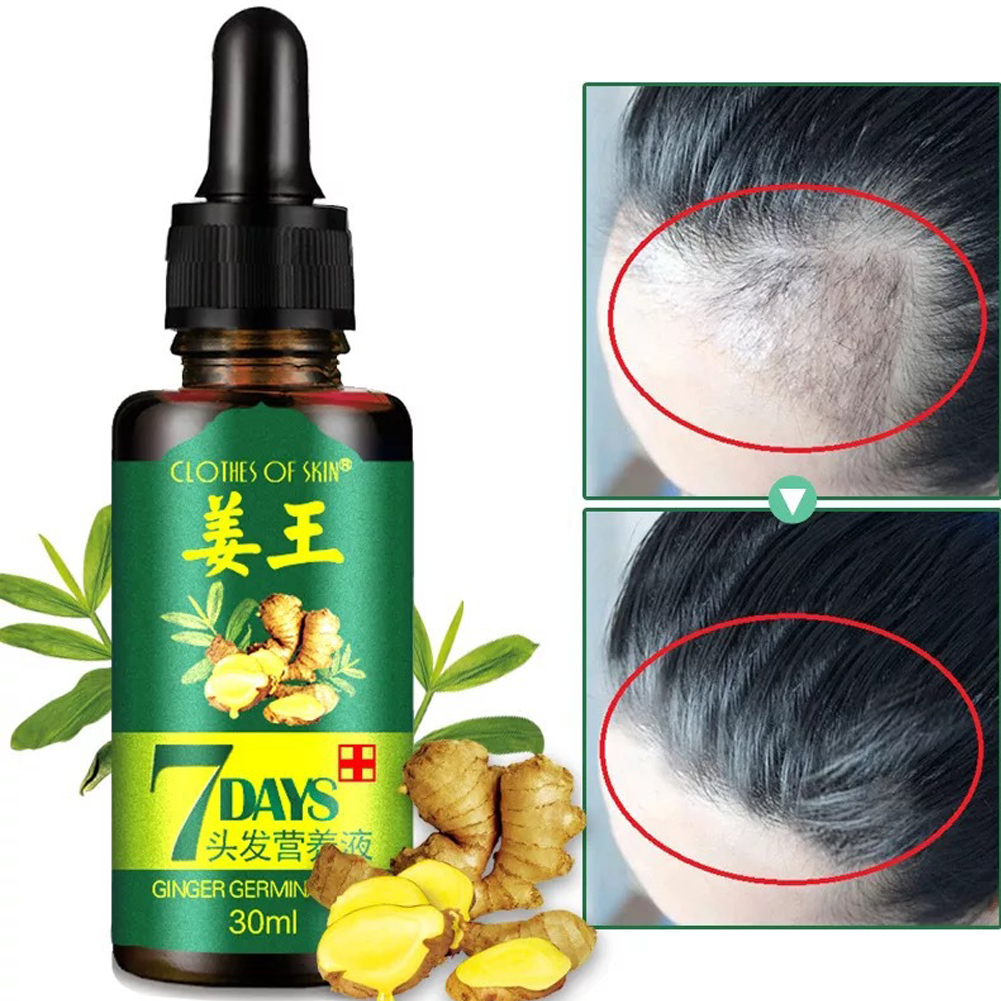 Growth Treatment Scalp Care Hair Lotion Essence Liquid Regrowth Anti-hair Loss Pilatory For Damaged Restoring