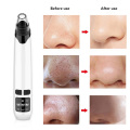 vacuum suction blackhead remover skincleaner remove blackheads vacuum whitehead remover vacuum cleaner pore black heads face