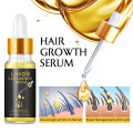 Ginger Fast Hair Growth Serum Essential Oil Anti Preventing Hair Lose Liquid Damaged Hair Repair Growing Anti-Hair Loss Conditio