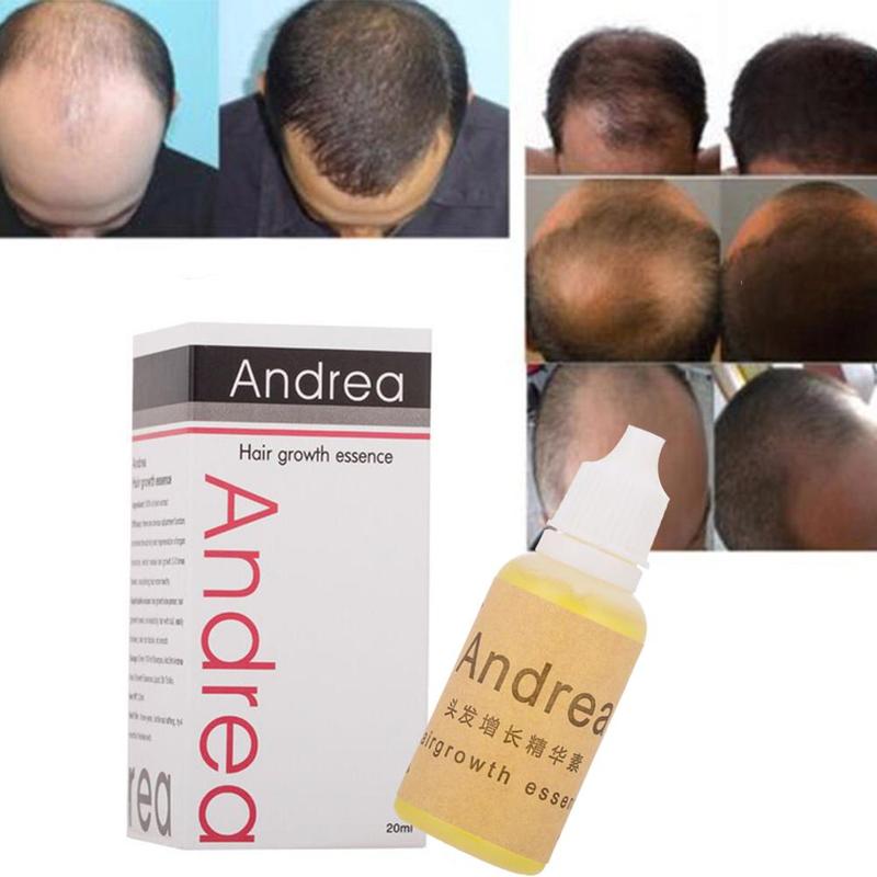 20ml 100% Natural Andrea Hair Growth Oil Thickener for Hair Growth Serum Hair Loss Product Plant Extract Liquid Oil