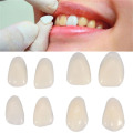 Dental Teeth care Veneers Ultra Thin Whitening Resin Anterior Upper Temporary Crown Porcelain Dental Material Oral Care