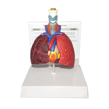 Medical Teaching Human Respiratory System Anatomy Model