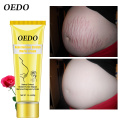 OEDO Scar Removal Cream Rose Remove Stretch Mark Cream Nourish Pregnant Women Skin Repair Remove Obesity Tattoo Body Care 40g