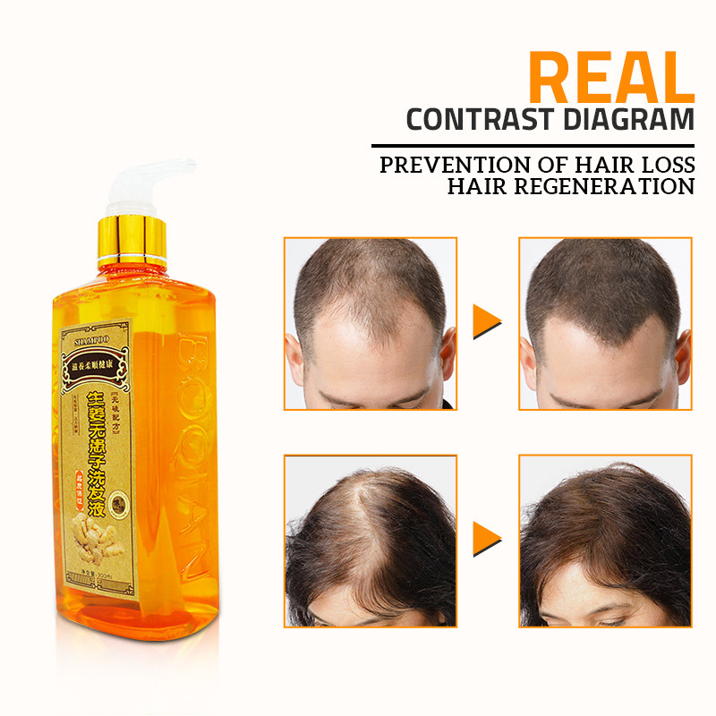 Hair Regrowth Professional Hair Ginger Shampoo 300ml Dense Fast Thicker Shampoo Anti Hair Loss Product Repair Nourish Supple