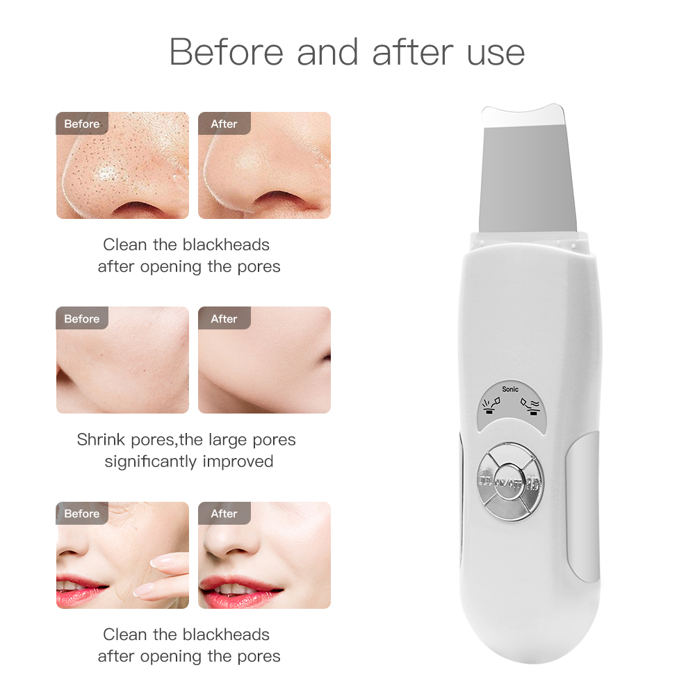 Ultrasonic Skin Scrubber Face Cleaner Deep Face Skin Peeling Massager Blackhead Removal Facial Scrubber Pore Clean Beauty Device