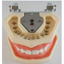Standard Teeth Model with Nuts Fixation