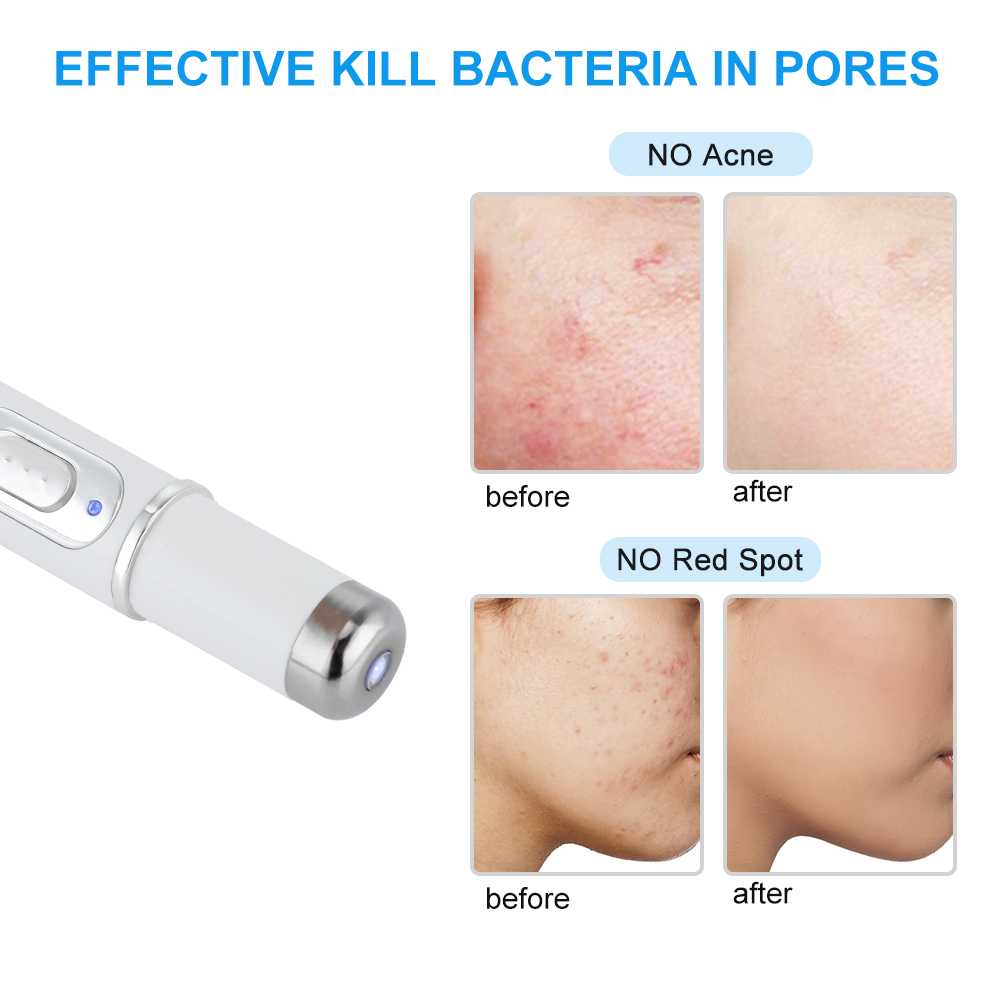 Acne Laser Pen Soft Scar Removal Machine Blue Light Therapy Pen Acne Treatment Wrinkle Removal Skin Care Tools Beauty Device