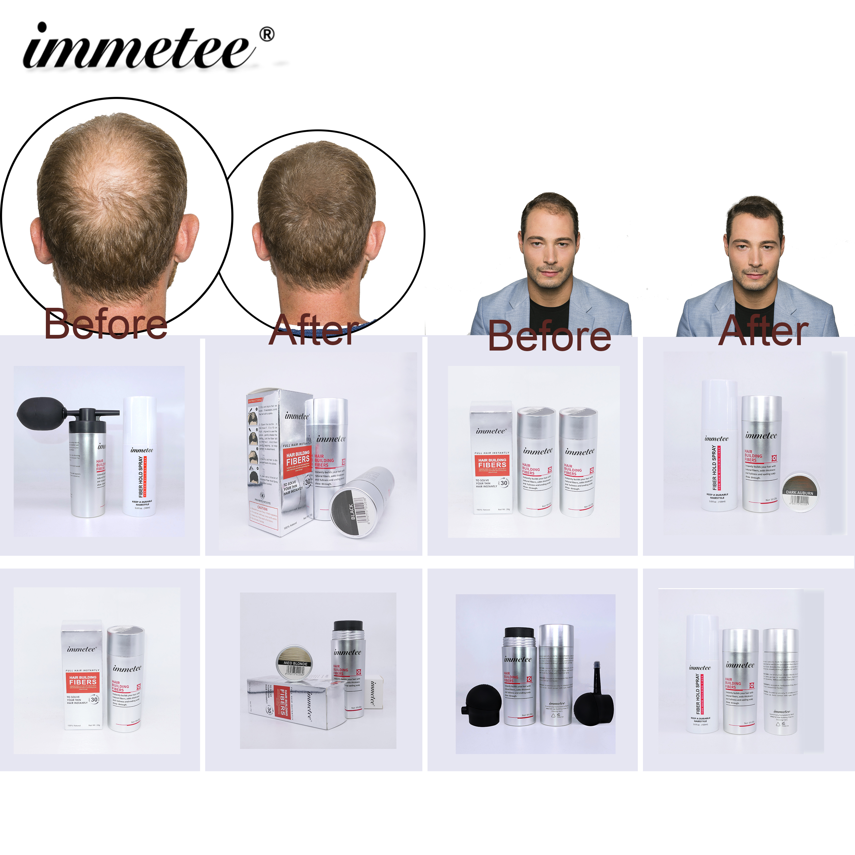immetee 28g Instantly Hair Growth Fiber Protein Hair Regrowth Treatment Hair Loss & Bald Patch Fiber 12 Color
