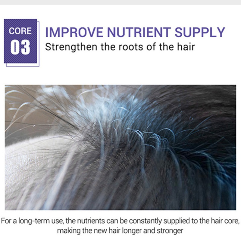 Kianomer Ginger Hair Growth Essential Oil Nourish Hair Follicles Anti-hair Loss Hair Care Oil Hair & Scalp Treatments
