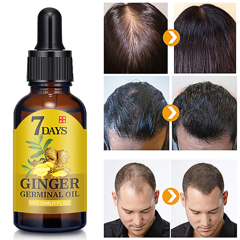 30ml Hair lotion Magic Fast Hair Growth Dense Regrowth Ginger Serum Oil Anti Loss Treatment Essence Hair Growth Tools Hair Care