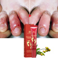 Mild Heel Repair Cream Anti Crack Whitening Cream Foot Peeling Cracked Hands Feet Dry Skin Moisturizing Care TSLM2