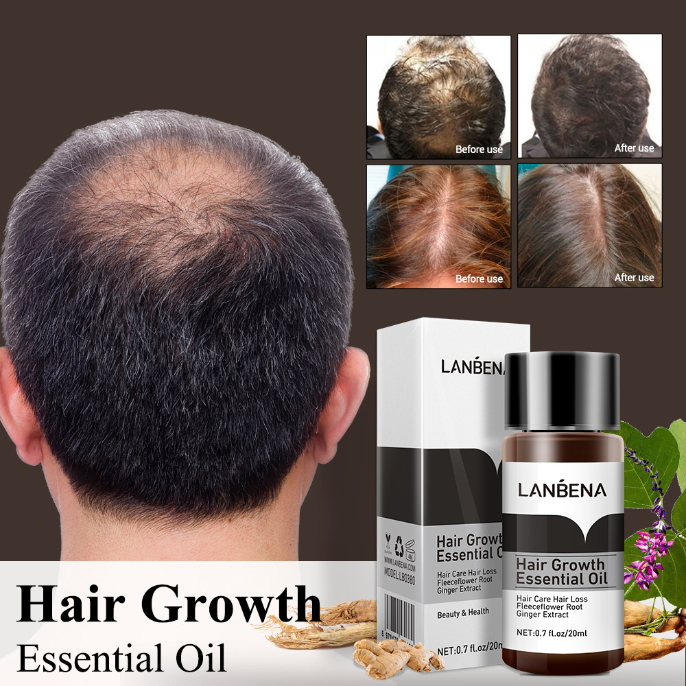 LANBENA Fast Powerful Hair Growth Essence Products Essential Oil Treatment Preventing Hair Loss Hair Care Andrea 20ml