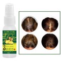 30ml Ginger Hair Care Growth Essence Oil Hair Loss Treatment Adult Hair Loss Products Naturally With No Side Effects Grow