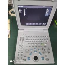 Laptop Ultrasound Diagnostic System SS-6B