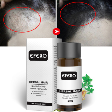 Efero 20ml Hair Growth Essential Oils Hair Beard Growth Serum Anti-hair Loss Products Hairs Care