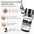 LANBENA Ginger Hair Growth Essential Oil Anti-hair Loss Nourish Hair Roots Consolidate Hair Loss Serum Hair Regeneration Product