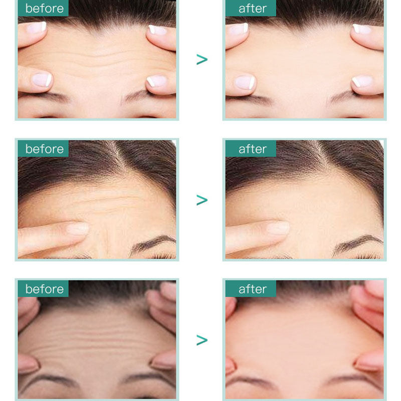smoothing and moisturizing forehead mask lifting head lines masks to reduce forehead lines eyebrows men and women mask