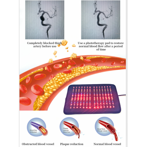 Red Light Therapy Pad Full Body Wearable Led Light Therapy Belt for Sale, Red Light Therapy Pad Full Body Wearable Led Light Therapy Belt wholesale From China