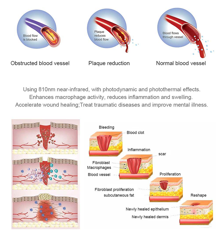 Red Light Therapy Bed Benefits