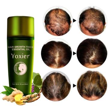 Yoxier Fast Hair Growth Essence Oil Hair Loss Treatment Help for hair Growth Hair Care Repair Growing Treatment Liquid TSLM2