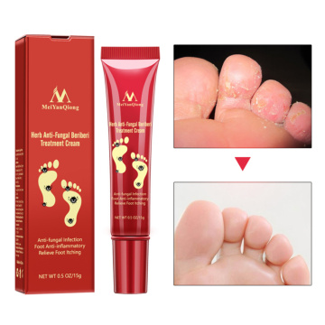 Mild Heel Repair Cream Anti Crack Whitening Cream Foot Peeling Cracked Hands Feet Dry Skin Moisturizing Care TSLM2