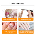 1 Pc Hands Feet Nail Care Whitening Toe Nail Fungal Fungus Removal Anti Cream Nourishing Repair Tool TSLM2