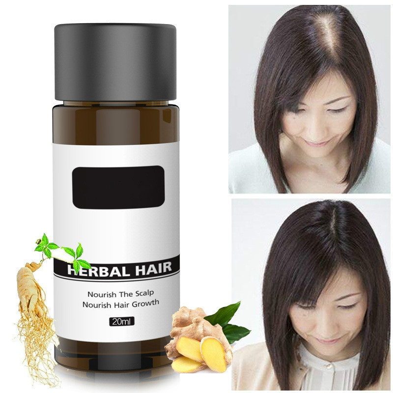 20ml Fast Hair Growth Ginger Hair Serum Essential Oils Dense Hair Growth Serum Hair Care Prevent Baldness Loss Serum