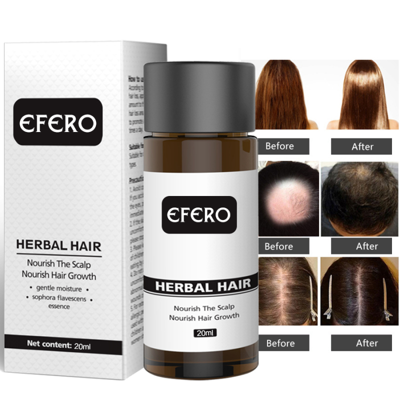 Efero Hair Care Hair Growth Essential Oils Hair Loss Dense Hair Fast Hair Growth Oil Grow Restoration Growing Serum TSLM2