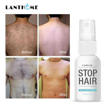 Powerful Permanent Painless Hair Removal Use Spray Stop Hair Growth Inhibitor Spray Body Facial Depilation Essence Liquid 20ML