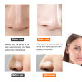 mini diamond dermabrasion skin care beauty machine vacuum blackhead acne remove face cleaning facial Pore Cleaner equipment