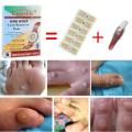 6pcs Medical Plaster Foot Corn Removal Remover Warts Thorn Patch For Foot Calluses atches Corn of eet Care