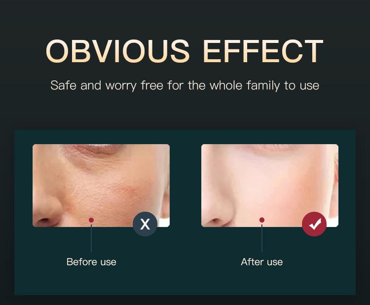 facial care device