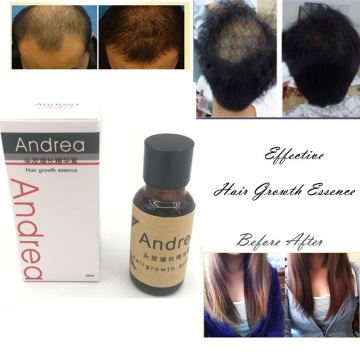 Andrea Hair Growth Ginger Oil Natural Plant Essence Faster Grow Beard Eyelashes Hair Tonic Shampoo Hair Loss Hair Care set