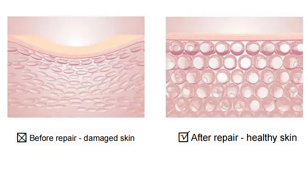 Repair effect of sodium hyaluronate