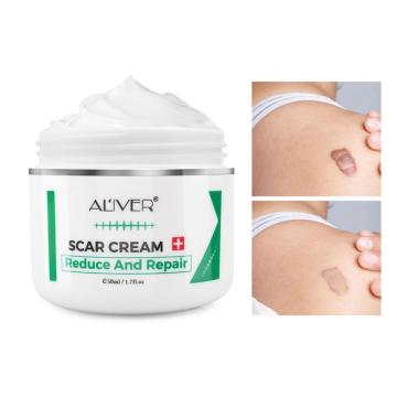 Scar Removal Cream Acne Wounds Cuts Mark Removal Ointment Cream Repairing Scars Moisturizing Promote Skin Renewal Skin Care Tool