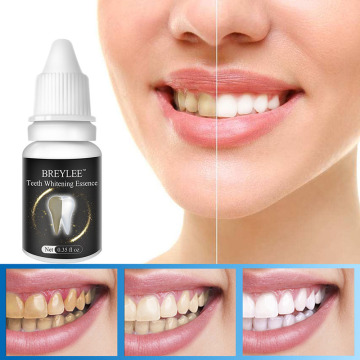 LANBENA removable veneers miracle false teeth overhead whitening stomatology Dentistry braces Dental Whitener tooth bleaching