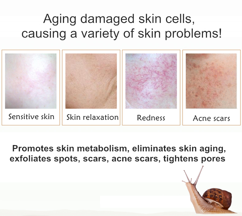 Dimollaure Strong Effect Whitening Cream + Snail Serum Anti-Aging Moisturizing Remove Freckle melasma pigment Melanin sunburn