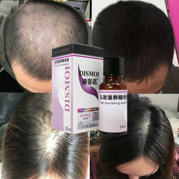 LAIKOU Hair Care Scalp Treatments Nutrition Hair Essential Oil Fast Powerful Hairs Growth Serum Repai Loss Fast Hairs Mask Care