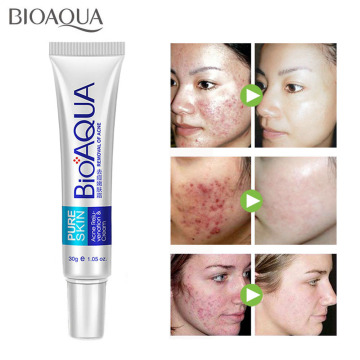 BIOAQUA Anti Acne Cream Removal Of Acne Removal Of Blackheads Whitening Cream Scar Remove Reduce Acne Oil Control Shrink Pores