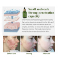 17ml Facial Anti Acne Serum Face Skin Whitening Repairing Essence Scar Blemish Pimple Removal Essence Women Skin Care TSLM1