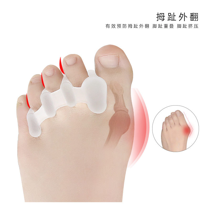 Three hole hallux valgus Overlapping toes Five toe separator Toe separator little finger Wearable shoe covers