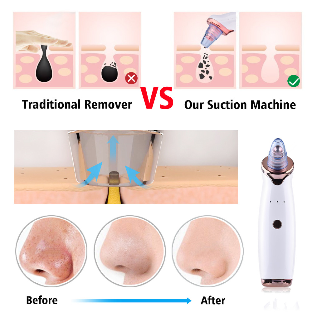 Blackhead Remover Vacuum Pore Cleaner Suction Face Deep Cleansing Nose Diamond Dermabrasion Remove Pimple Machine Skin Care Tool