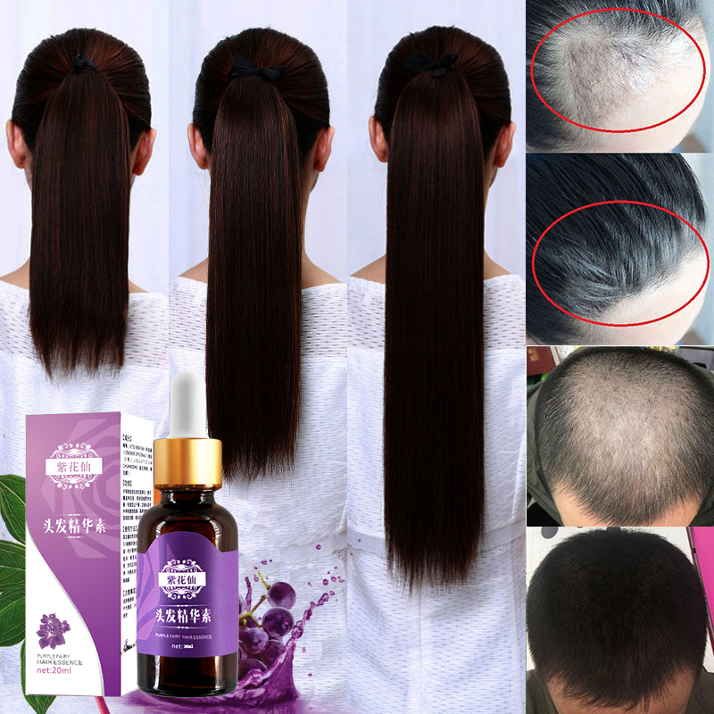 5 pcs Hair Loss Product Hair Growth Essential Oil Faster Grow Hair Regrowth Easy To Carry Hair Care Liquid Serum Hair Care Oil