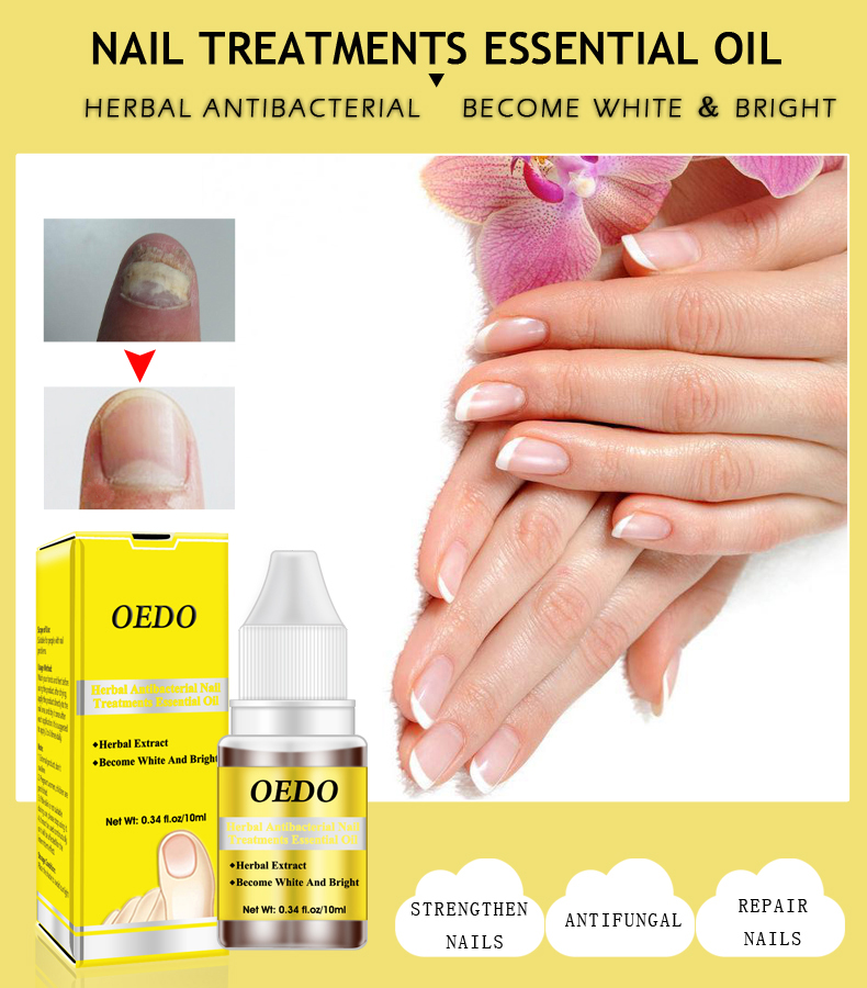 High Quality 10ml Nail Fungus Treatment for Onychomycosis Removal Antifungal Nail Care Repair Solution
