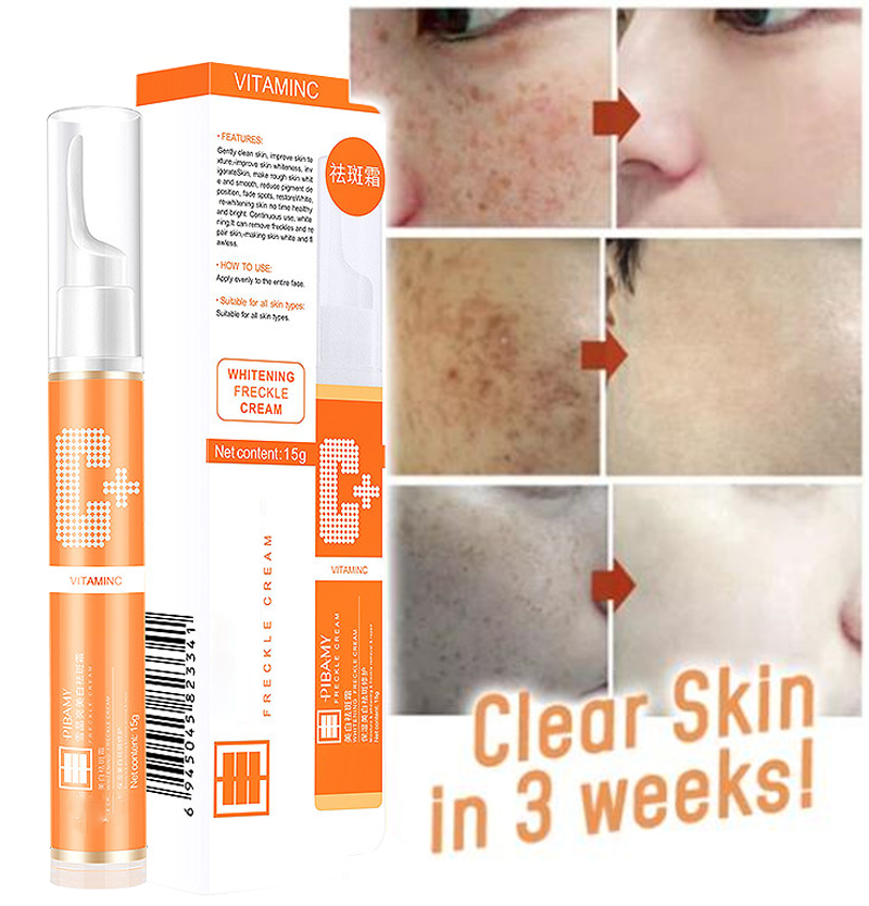 Instant Blemish Removal Gel Vitamin C Whitening Anti Freckle Cream Pen Effectively Remove the Freckle Pigmented Melanin Spots