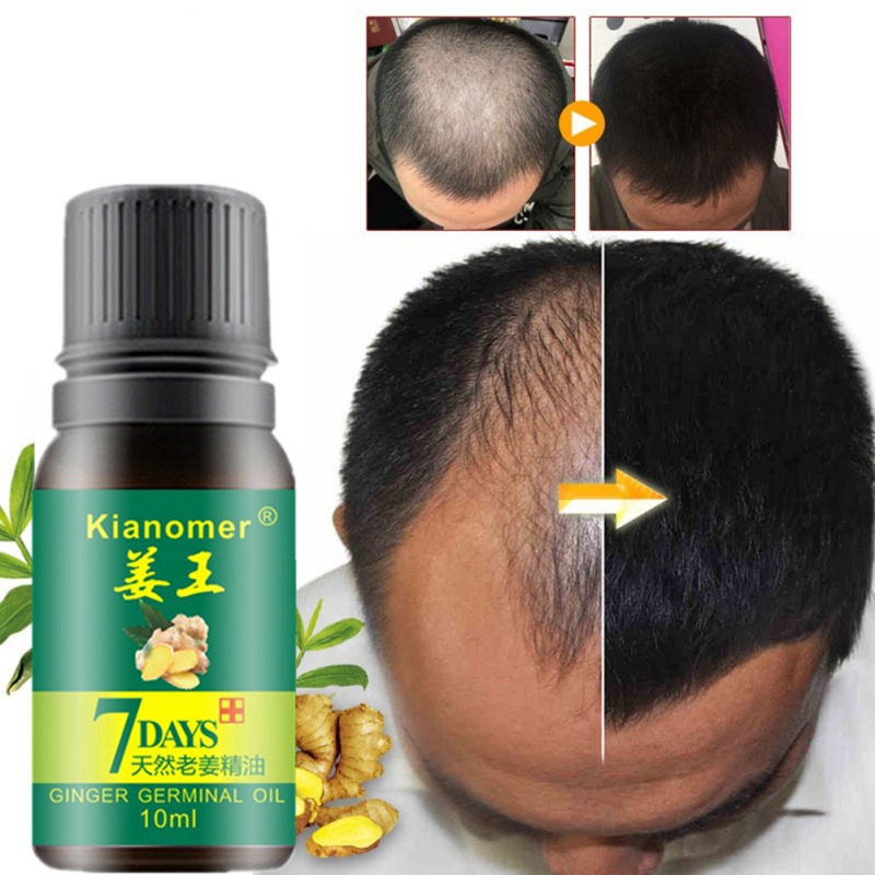 Kianomer Ginger Hair Growth Essential Oil Nourish Hair Follicles Anti-hair Loss Hair Care Oil Hair & Scalp Treatments