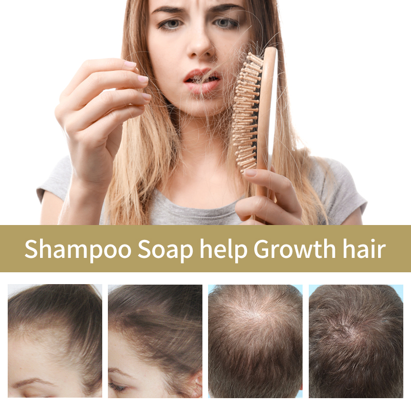Natural Ginger Oil Shampoo Bar Pure Essential Oils Anti Hair Loss Shampoo Soap Hair Growth Product Hair Care Handmade